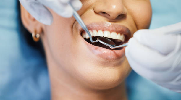 Best Broken or Cracked Tooth Emergency Dentist in Temecula, CA